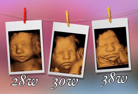 My Forever Blessing 3D 4D Ultrasound (call or Text to book Flexible hrs)
